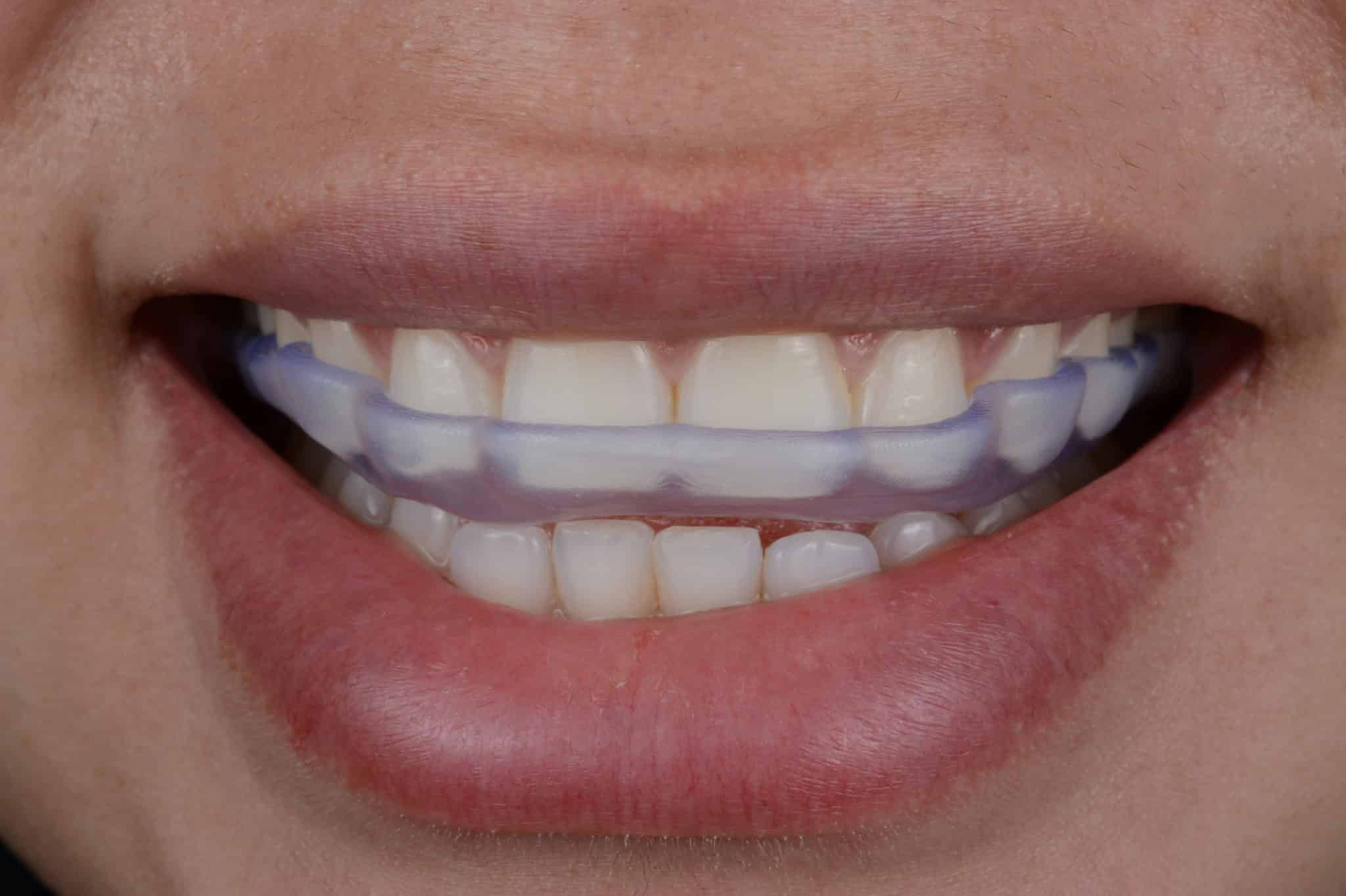 SmileGuard™